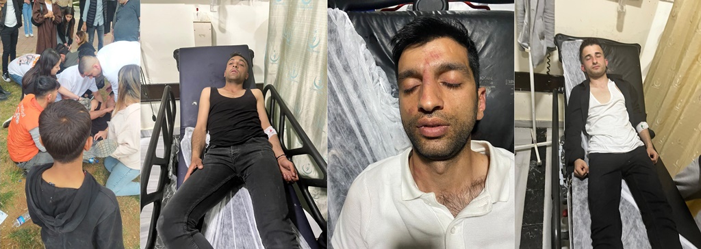 AK Parti ve CHP’liler arasında kavga çıktı “5 Kişi yaralandı”