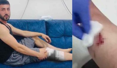 Gaziantep’te Peş Peşe Köpek Saldırıları: 1 Kadın, 2 Kişi Yaralandı