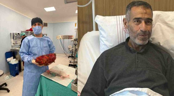 Gaziantep’te Tıp Dünyasını Şaşırtan Olay