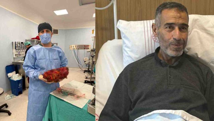 Gaziantep’te Tıp Dünyasını Şaşırtan Olay